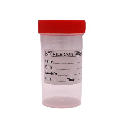 50 ml/60 ml PP пластиковый стакан для сбора стула для бутылки для проб в лабораторных принадлежностях